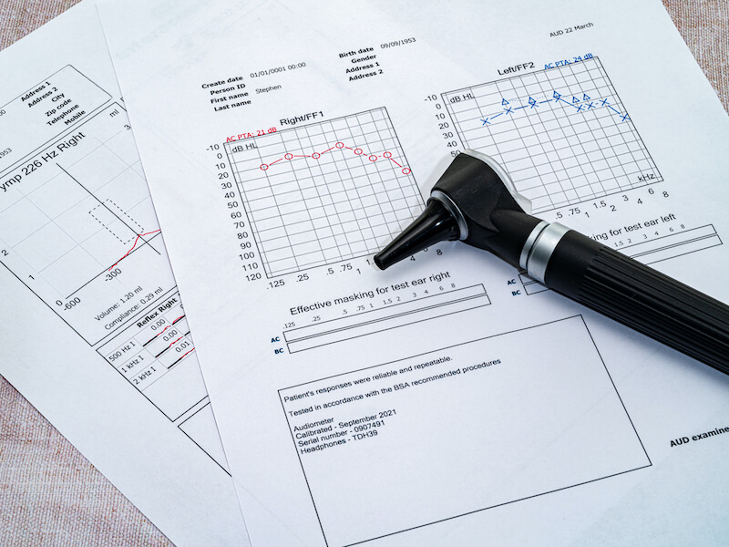 An audiologists Otoscope placed on an Audiogram following a hearing test